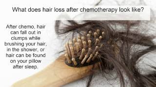 Hair Loss From Chemotherapy What Is It? Who Gets It? How Do We Treat It?