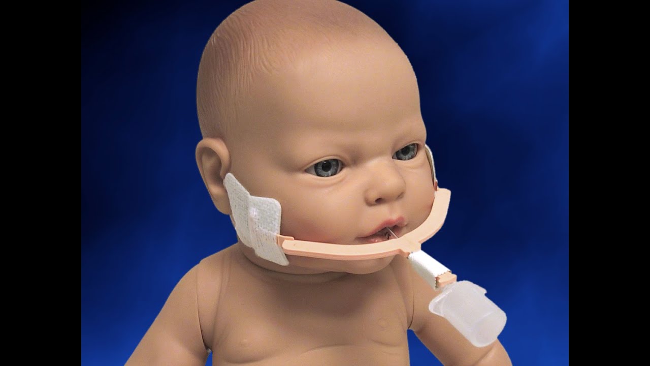 NEOBAR Sujeccion para Tubo Endotraqueal    Video Instrucciones de Uso