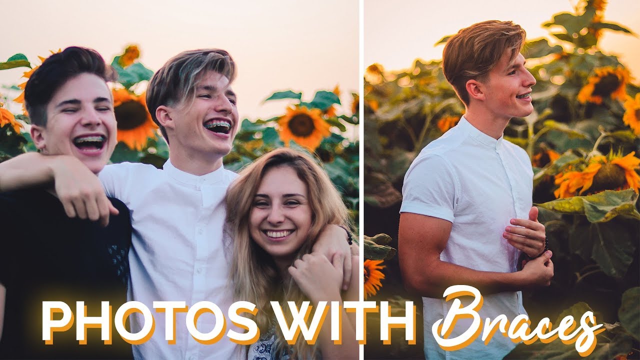 How To Take Good Pictures With Braces | Photogenic Braces