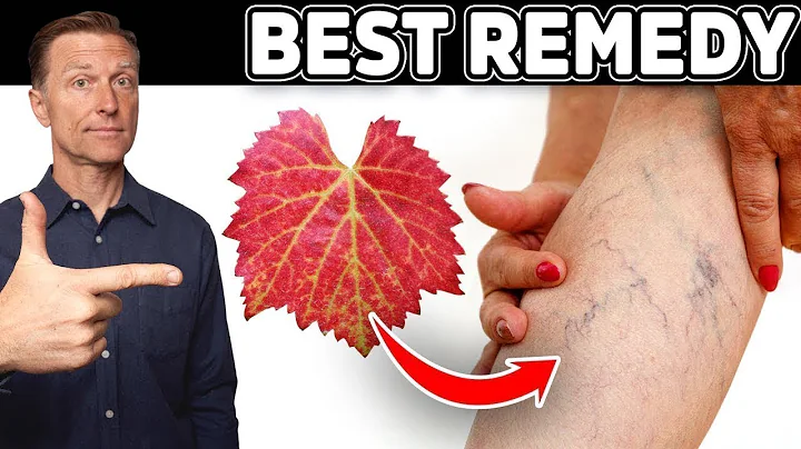Venous Insufficiency: This is the Most Effective a...