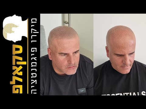 סרטון המלצה על סקאלפ