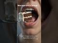 WHAT SUGAR REALLY DOES TO YOUR BODY 3D-ANIMATION