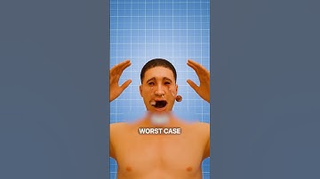 Can You Sneeze With Your Eyes Open 😱 Surgeon Reacts