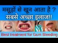 BLEEDING GUMS  CAUSES , TREATMENT  & PREVENTION  ( HINDI )  # DENTAL AWARENESS.