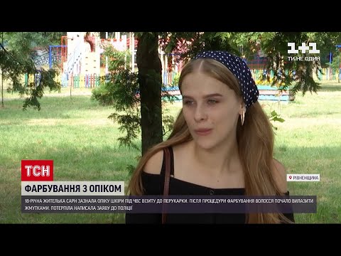 Новини України: опік голови та втрата волосся –жителька Сарн оговтується від візиту до перукарки