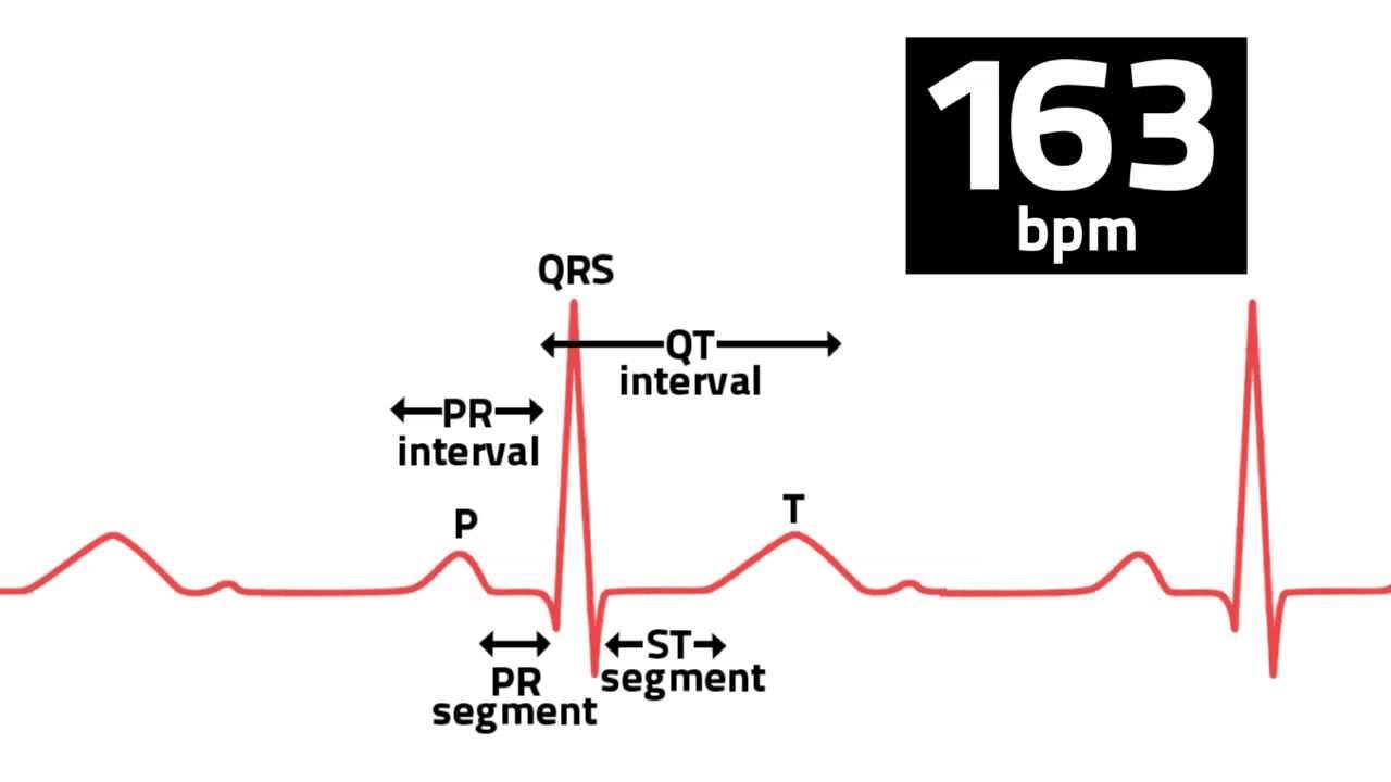 Medical Grade ECG YouTube