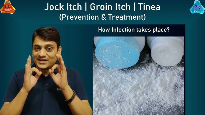 How to Treat Jock Itch Fast  Jock Itch Treatment, Causes, and