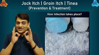 Jock Itch | Prevention and Treatment | जाँघों के बीच खुजली और दाद का इलाज | Fungal Infection