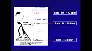 4.2.d. Accelerated Idio-junctional Rhythm  - Tachyarrhythmias