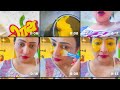 आँख के काले धब्बे कैसे हटाये #ipace#facecare #darkspots #skincare #hinditricks #sonalipatel ￼￼