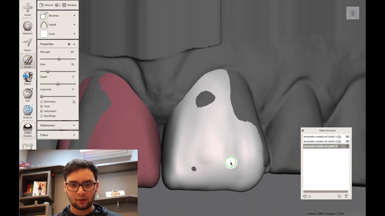 Enceramento Digital #4: Finalizando a Palatina no Meshmixer