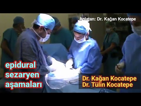 Epidural sezaryen ile doğum-Ameliyathane görüntüleri-Dr. Kağan Kocatepe