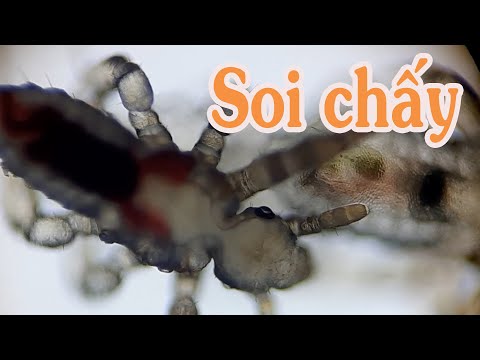 SOI CHẤY DƯỚI KÍNH HIỂN VI XEM NTN, BẠN KHÔNG TIN NỔI | lice under a microscope