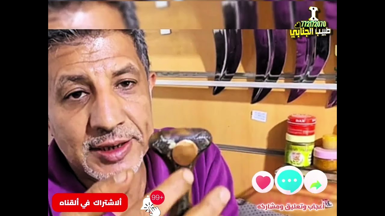 جنابي خف ألجمل مشاكل وعيوب ونصيحه حولها #طبيب_ألجنابي #جنبيه #جنابي #زراف #صيفاني #اليمن #السعودية 