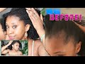How I grew my edges back AGAIN | Hair Update & What worked