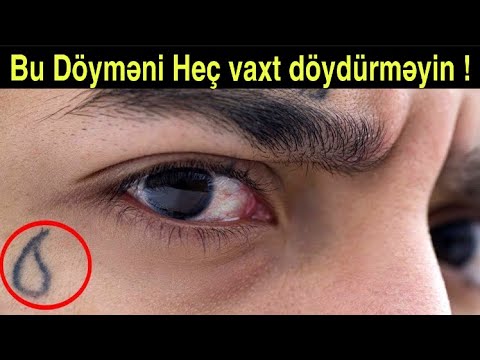 Video: Dişli mənada?