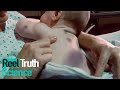 The Baby Who Bruised Easily | Mystery Diagnosis | ReelTruth #Science