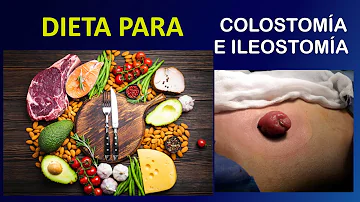 ¿Qué alimentos pueden obstruir una ileostomía?