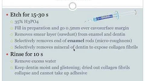 Operative Dentistry Part 2