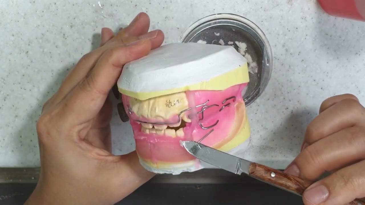 Functional Regulator 2 resin pouring (Dentarum)