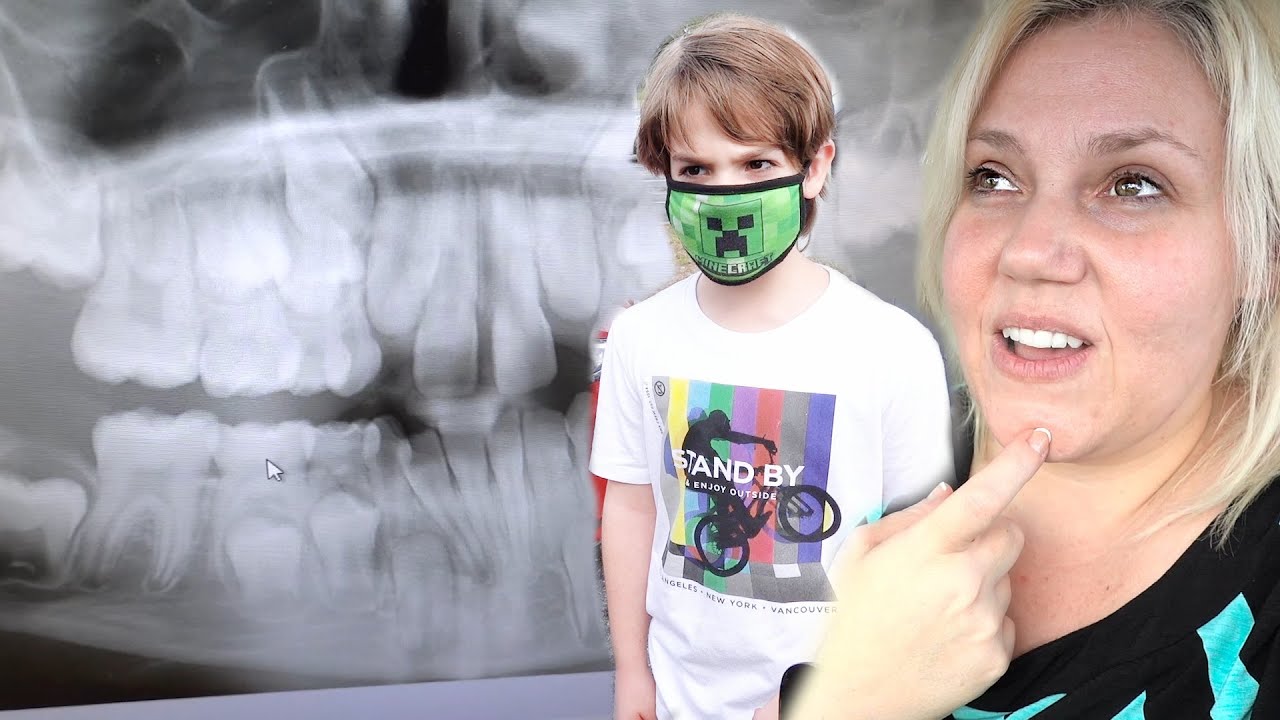 Too Young For Braces YouTube