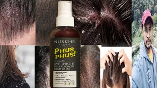 Nuskhe By Paras Phus Phus Overnight Hair Growth Rice Mist Honest Review