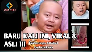 viral bayi berwajah tua terlahir di thailand dan penyebabnya #baby #bayiwajahtua #bayituathailand
