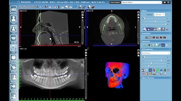 Planmeca Romexis - Creating a Psuedo Pan