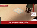 لیزر موهای زائد فیلم لیزر موهای زائد کلینیک پوست و مو هلیا شماره 4 