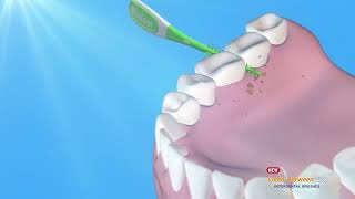 Wisdom Clean Between Pro Interdental Brushes screenshot 3