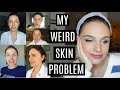 VLOG: my weird skin problem (FINALLY opening up!) + lululemon haul