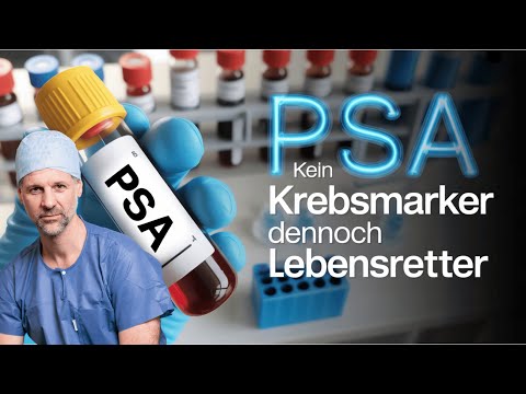 Prostata-Test PSA: Fakten, die Männer wissen müssen!