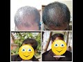 Final Result of HT in Dhi method,for any details plz contact us on what's app 8850884116