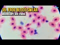 35. Frog Blood Smear (Microscope 40x-2500x)