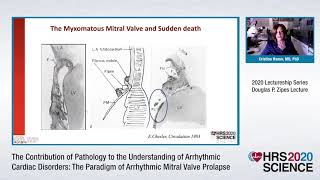 HRS 2020 Douglas P. Zipes Lectureship: Cristina Basso, MD, PhD screenshot 3