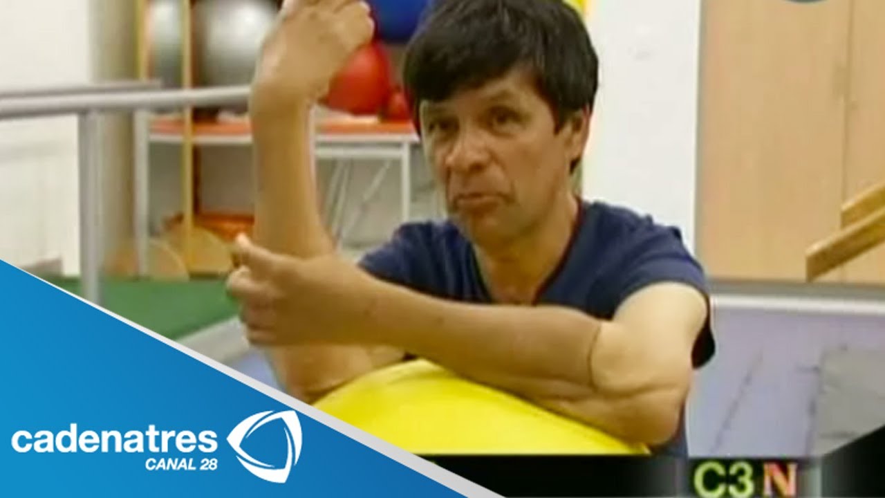 Hombre recibe un doble transplante de brazos con éxito