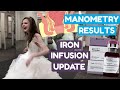 Tips For Wedding Dress Shopping with a Feeding Tube | Iron Infusion Update & Manometry Results
