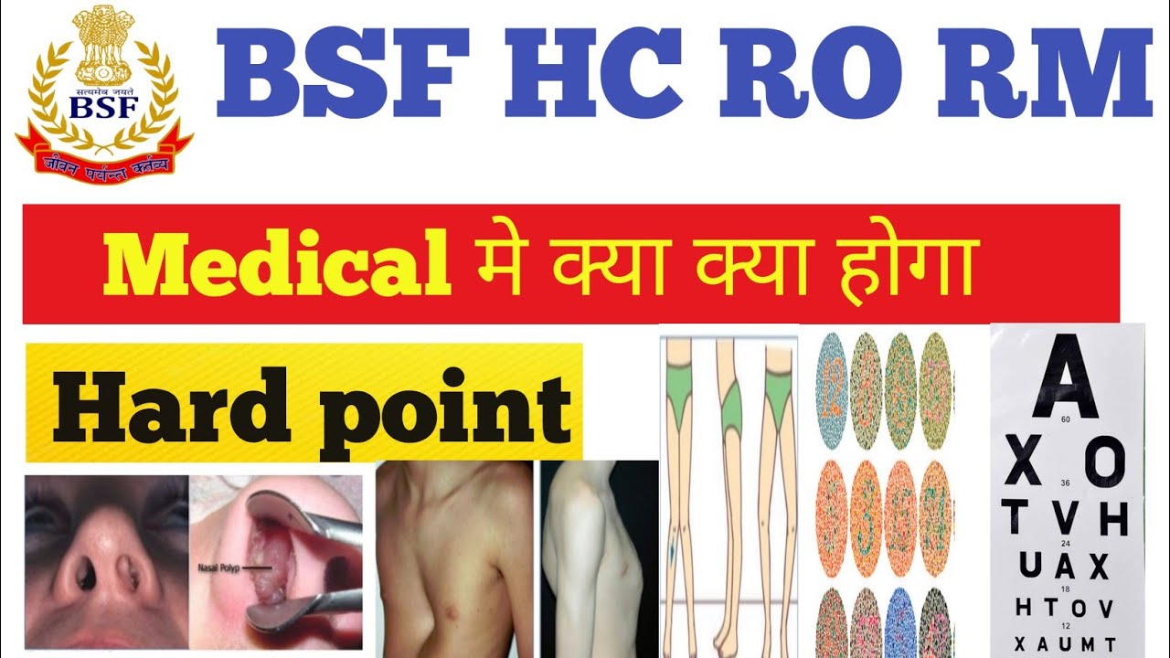 BSF RO RM medical update. bsf hc ro rm medical hard point