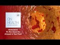 Cholesterol: It’s Not About the Amount in Your Food