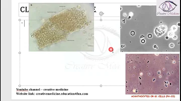 Lec 14 Dysmorphic RBC || Renal