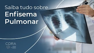 Tudo sobre Enfisema Pulmonar - DPOC - com Dra. Carolina Salim