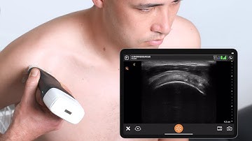 How to Scan the Shoulder - Ultrasound Scanning Technique