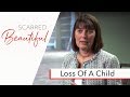 Dr. Mary Neal, Her Loss, Her Hope | Scarred Beautiful Story