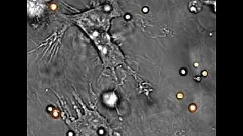 S8_Dendritic_Cells_Dragging_Conidia_in_Collagen