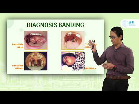 Video: Tonsilitis Vs Radang Tenggorokan: Apa Perbedaannya?