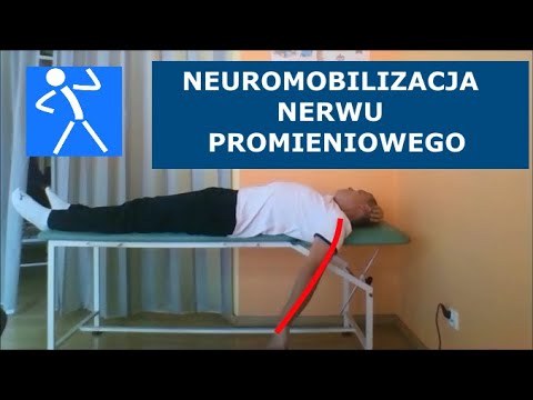 Wideo: Uraz Nerwu Promieniowego: Przyczyny, Objawy I Diagnoza