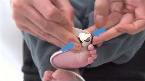 Nonin 8008J 8001J Neo Infant Flexi Wrap Pulse Ox Sensors