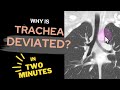 Why trachea 🫁 is deviated to RIGHT ⬅️🤔❓ In TWO 2️⃣ MINUTES