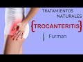 TROCANTERITIS [bursitis trocanterea] ➠ TRATAMIENTOS efectivos y naturales