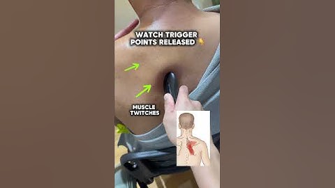 WHAT YOUR RHOMBOID PAIN IS LOOKING FOR 🤩🤩🤩 #rhomboids #scapularpain #backpain #viralvideo